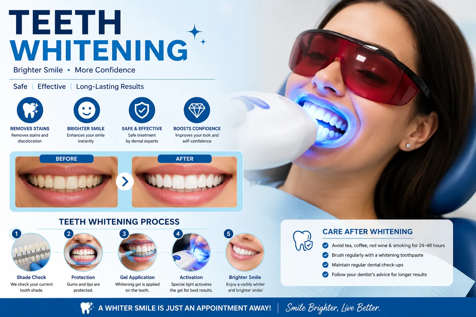 Teeth Whitening